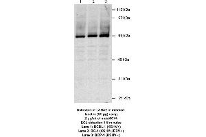 Image no. 1 for anti-Latency-Associated Nuclear Antigen 2 (LANA2) antibody (ABIN363228) (Latency-Associated Nuclear Antigen 2 (LANA2) Antikörper)