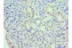 Immunohistochemistry of paraffin-embedded human pancreatic tissue using ABIN7155328 at dilution of 1:100 (HDAC8 Antikörper  (AA 1-377))