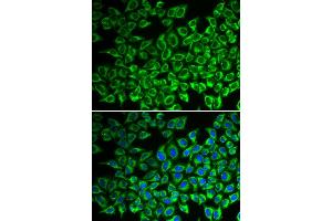 Immunofluorescence (IF) image for anti-Interleukin 12 Receptor beta 1 (IL12RB1) antibody (ABIN1980210) (IL12RB1 Antikörper)