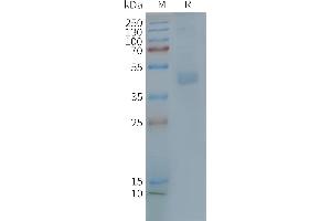 Human CX3CR1-Nanodisc, Flag Tag on SDS-PAGE (CX3CR1 Protein)