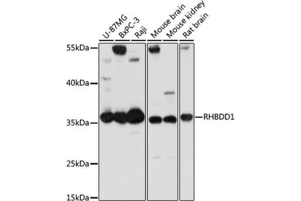 RHBDD1 Antikörper  (AA 206-315)