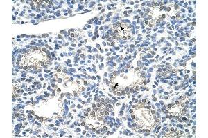 ZNF786 antibody was used for immunohistochemistry at a concentration of 4-8 ug/ml to stain Alveolar cells (arrows) in Human Lung. (ZNF786 Antikörper  (N-Term))