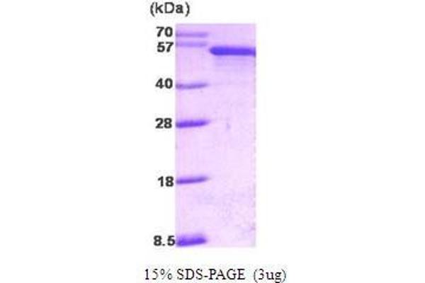 PDCD4 Protein (AA 1-469)