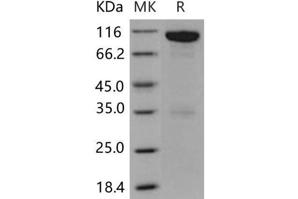 EPH Receptor A6 Protein (Epha6) (Fc Tag)