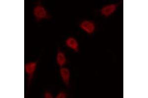 ABIN6269401 staining Hela by IF/ICC. (RPS6KB2 Antikörper  (C-Term))