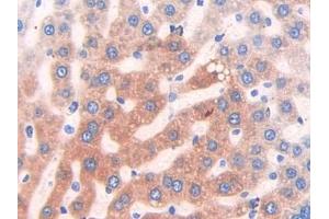 IHC-P analysis of Rat Liver Tissue, with DAB staining. (CYP2E1 Antikörper  (AA 126-309))