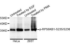 Western blot analysis of extracts of various cell lines, using Phospho-RPS6KB1-S235/236 antibody. (RPS6KB1 Antikörper)