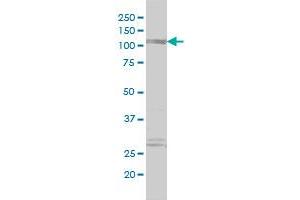 PDE4DIP monoclonal antibody (M01), clone 2B5 Western Blot analysis of PDE4DIP expression in JAR . (PDE4DIP Antikörper  (AA 1-177))