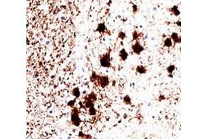 IHC staining of human brain with PGP9. (UCHL1 Antikörper)