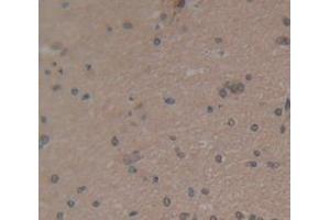 IHC-P analysis of Human Tissue, with DAB staining. (Osteocalcin Antikörper  (AA 21-99))