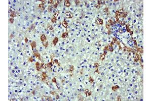 Immunohistochemistry (Paraffin-embedded Sections) (IHC (p)) image for anti-Nitric Oxide Synthase 2, Inducible (NOS2) (AA 14-100) antibody (ABIN677228)