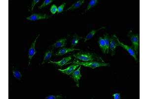 Immunofluorescence staining of Hela cells with ABIN7163135 at 1:200, counter-stained with DAPI. (Sphingomyelin Synthase 2 Antikörper  (AA 1-79))