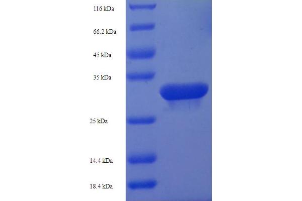 HDDC3 Protein (AA 2-140) (His-SUMO Tag)