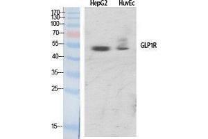 Western Blotting (WB) image for anti-Glucagon-Like Peptide 1 Receptor (GLP1R) (Internal Region) antibody (ABIN3175279) (GLP1R Antikörper  (Internal Region))