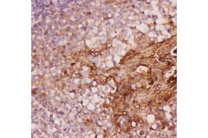 Anti-Annexin A1 Picoband antibody,  IHC(P): Human Tonsil Tissue (Annexin a1 Antikörper  (AA 2-346))