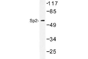 Image no. 1 for anti-Sp2 Transcription Factor (Sp2) antibody (ABIN272208) (Sp2 Antikörper)