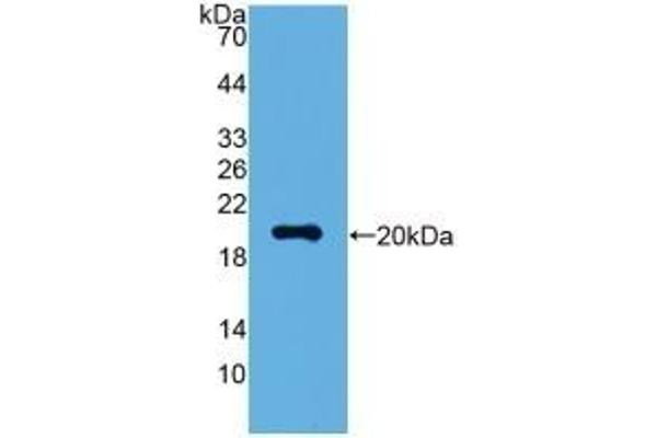 VSNL1 Antikörper  (AA 39-184)