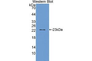 Western blot analysis of the recombinant protein. (CYP2E1 Antikörper  (AA 126-309))