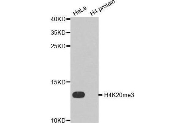 Histone H4 Antikörper  (3meLys20)