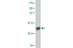 Western Blot detection against Immunogen (36. (FLT4 Antikörper  (AA 34-133))