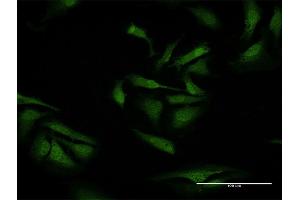 Immunofluorescence of purified MaxPab antibody to TXNDC9 on HeLa cell. (TXNDC9 Antikörper  (AA 1-188))