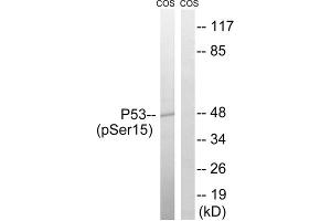 Western blot analysis of extracts from COS7 cells, using p53 (Phospho-Ser15) antibody. (p53 Antikörper  (pSer15))