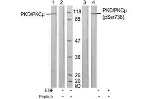 Image no. 1 for anti-Protein Kinase D1 (PRKD1) (Ser738) antibody (ABIN197313) (PKC mu Antikörper  (Ser738))