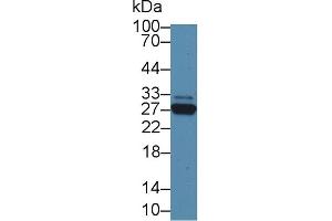 Detection of CRP in Rat Serum using Polyclonal Antibody to C Reactive Protein (CRP) (CRP Antikörper  (AA 20-225))