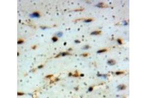 Used in DAB staining on fromalin fixed paraffin-embedded Heart tissue (ADIPOQ Antikörper  (AA 108-244))