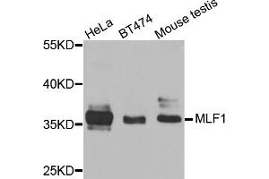 Western blot analysis of extracts of various cell lines, using MLF1 antibody (ABIN5974950) at 1/1000 dilution. (MLF1 Antikörper)