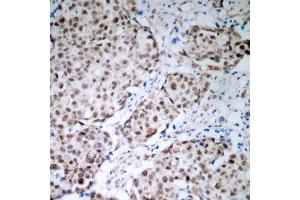 Immunohistochemistry (IHC) image for anti-Tumor Protein P53 (TP53) (pSer315) antibody (ABIN1870685) (p53 Antikörper  (pSer315))