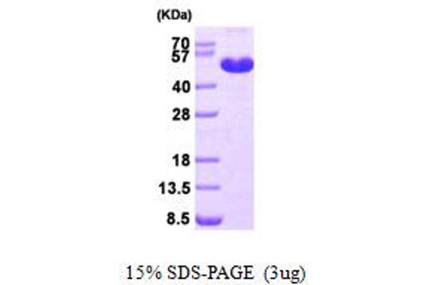 MAT1A Protein (AA 1-395) (His tag)