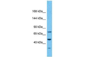 Host:  Rabbit  Target Name:  PKD2  Sample Type:  Stomach Tumor lysates  Antibody Dilution:  1. (PKD2 Antikörper  (N-Term))