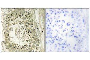 Immunohistochemistry (IHC) image for anti-Hepatocyte Growth Factor-Regulated tyrosine Kinase Substrate (HGS) (Internal Region) antibody (ABIN1848946) (HGS Antikörper  (Internal Region))