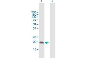 Western Blot analysis of ST6GAL1 expression in transfected 293T cell line by ST6GAL1 MaxPab polyclonal antibody. (ST6GAL1 Antikörper  (AA 1-175))