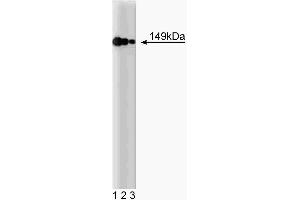 Western blot analysis of AKAP149 on a HeLa cell lysate (Human cervical epitheloid carcinoma, ATCC CCL-2. (AKAP1 Antikörper  (AA 66-212))