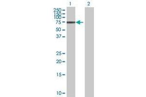 Lane 1: ADAM2 transfected lysate ( 63. (ADAM2 293T Cell Transient Overexpression Lysate(Denatured))