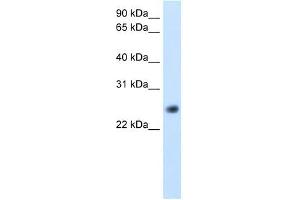 GGTLA4 antibody used at 5 ug/ml to detect target protein. (GGTLC1 Antikörper  (C-Term))