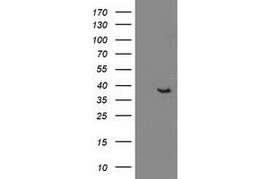 Western Blotting (WB) image for anti-DnaJ (Hsp40) Homolog, Subfamily B, Member 1 (DNAJB1) antibody (ABIN1498736) (DNAJB1 Antikörper)