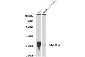 Western blot analysis of extracts of various cell lines, using HLA-DRA antibody (ABIN6131758, ABIN6141828, ABIN6141830 and ABIN6215479) at 1:1000 dilution. (HLA-DRA Antikörper  (AA 26-216))
