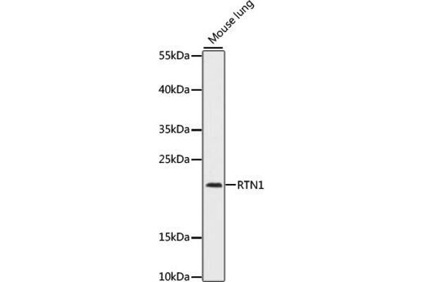 Reticulon 1 Antikörper  (AA 80-340)