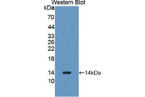 Detection of Recombinant PLOD3, Human using Polyclonal Antibody to Procollagen Lysine-2-Oxoglutarate-5-Dioxygenase 3 (PLOD3) (PLOD3 Antikörper  (AA 647-738))