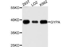 Western blot analysis of extracts of various cell lines, using GYPA antibody (ABIN5995718) at 1/1000 dilution. (CD235a/GYPA Antikörper)