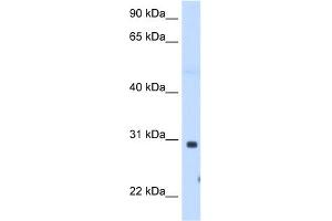 WB Suggested Anti-ST3GAL3 Antibody Titration:  1. (ST3GAL3 Antikörper  (C-Term))