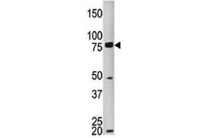 Western blot testing of MELK antibody and HEPG2 lysate. (MELK Antikörper  (AA 525-554))