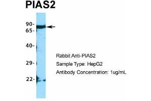 Host:  Rabbit  Target Name:  PIAS2  Sample Type:  HepG2  Antibody Dilution:  1. (PIAS2 Antikörper  (C-Term))