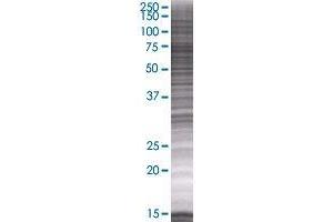 ADAM2 transfected lysate. (ADAM2 293T Cell Transient Overexpression Lysate(Denatured))