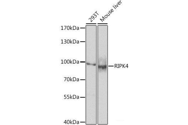 RIPK4 Antikörper