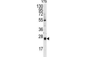 Western Blotting (WB) image for anti-Ubiquitin-Conjugating Enzyme E2E 3 (UBE2E3) antibody (ABIN3001488) (UBE2E3 Antikörper)