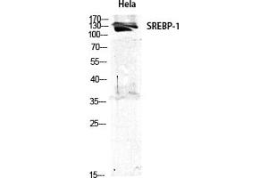 Western Blot analysis of various cells using SREBP-1 Polyclonal Antibody diluted at 1:1000. (SREBF1 Antikörper)